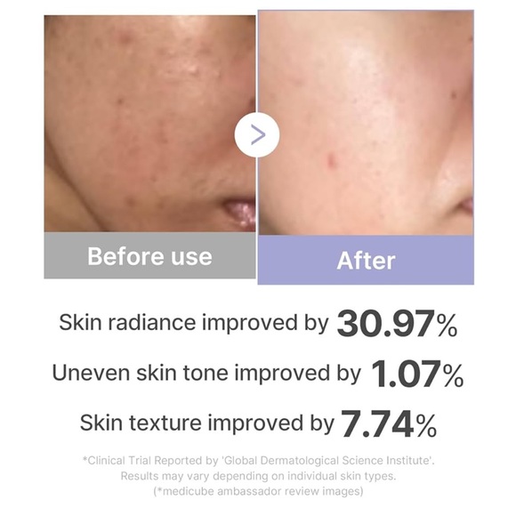 medicube AGE R Mini Booster Pro Pink Glow Booster Facial Device NEW SEALED BOX - Picture 5 of 8